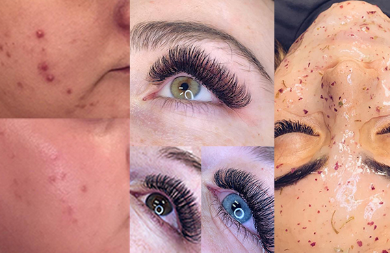 best-park-city-spa-simply-blush-esthetics